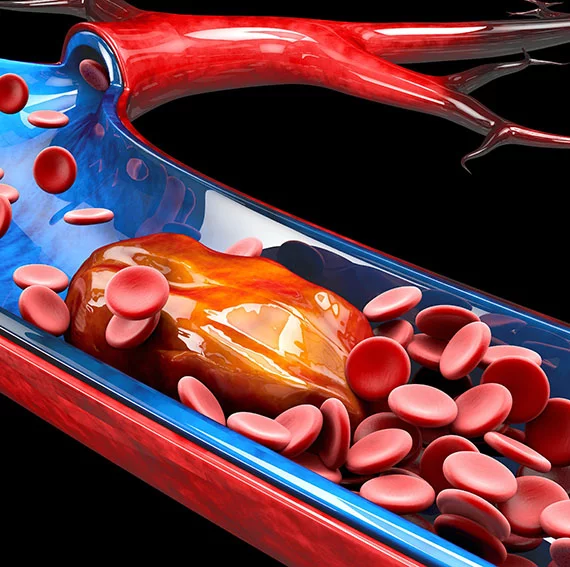 Embolic Protection Components